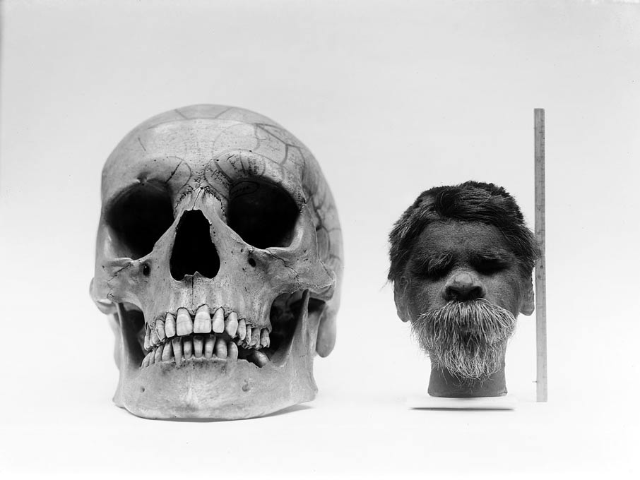 Shrunken head compared with normal human skull. 