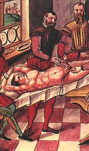 The procedure of castration as punishment during Middle-ages.